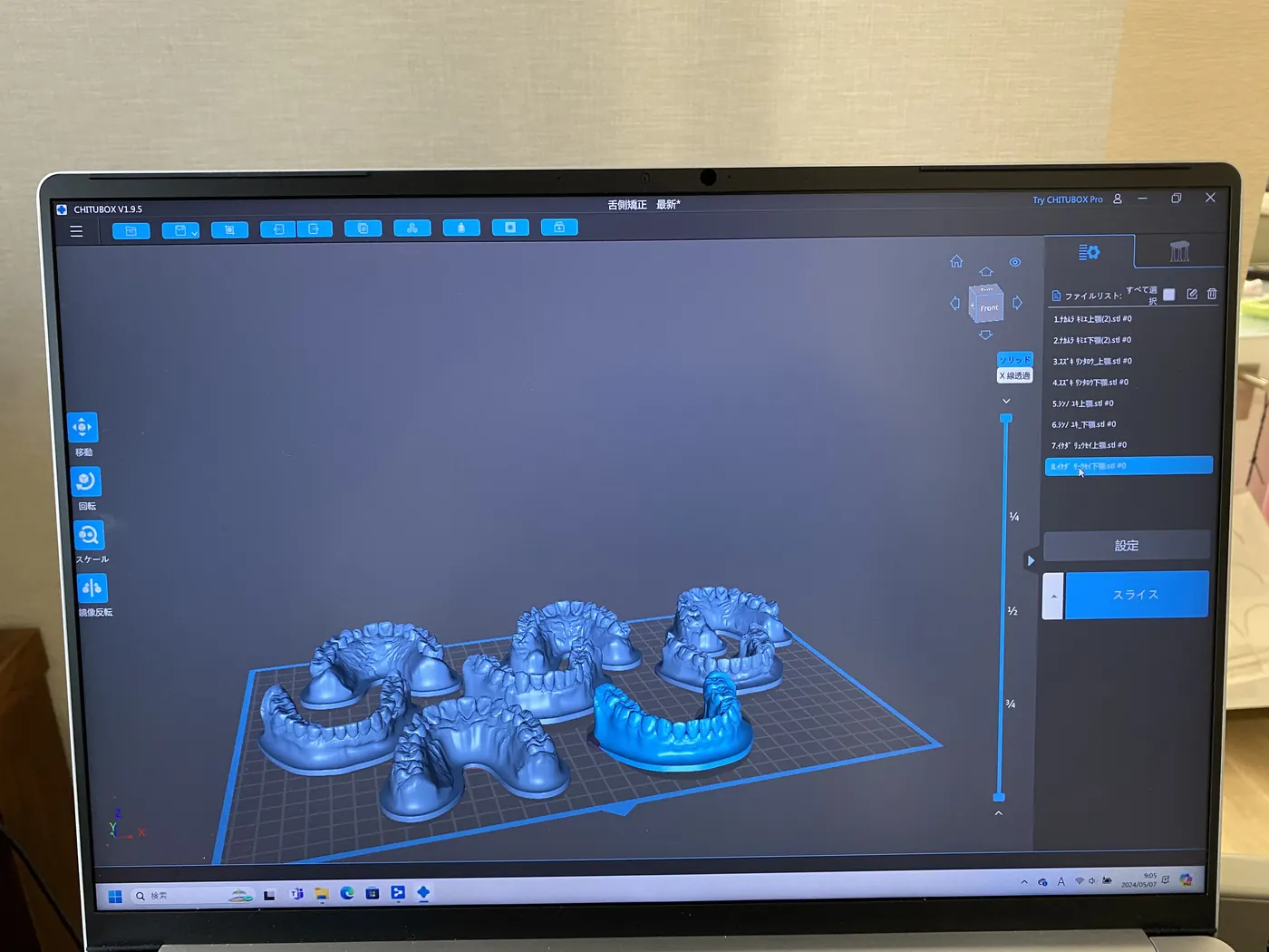 院内でアライナーをつくるための3Dデータの画面