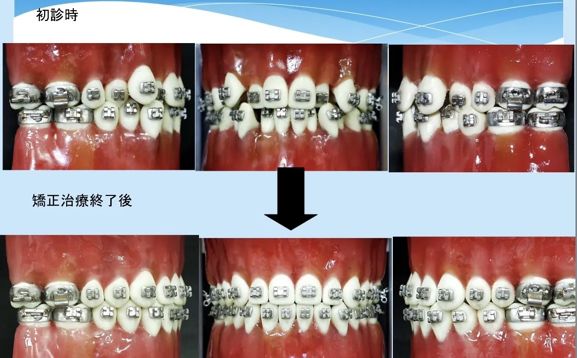 タイポドント実習の記録